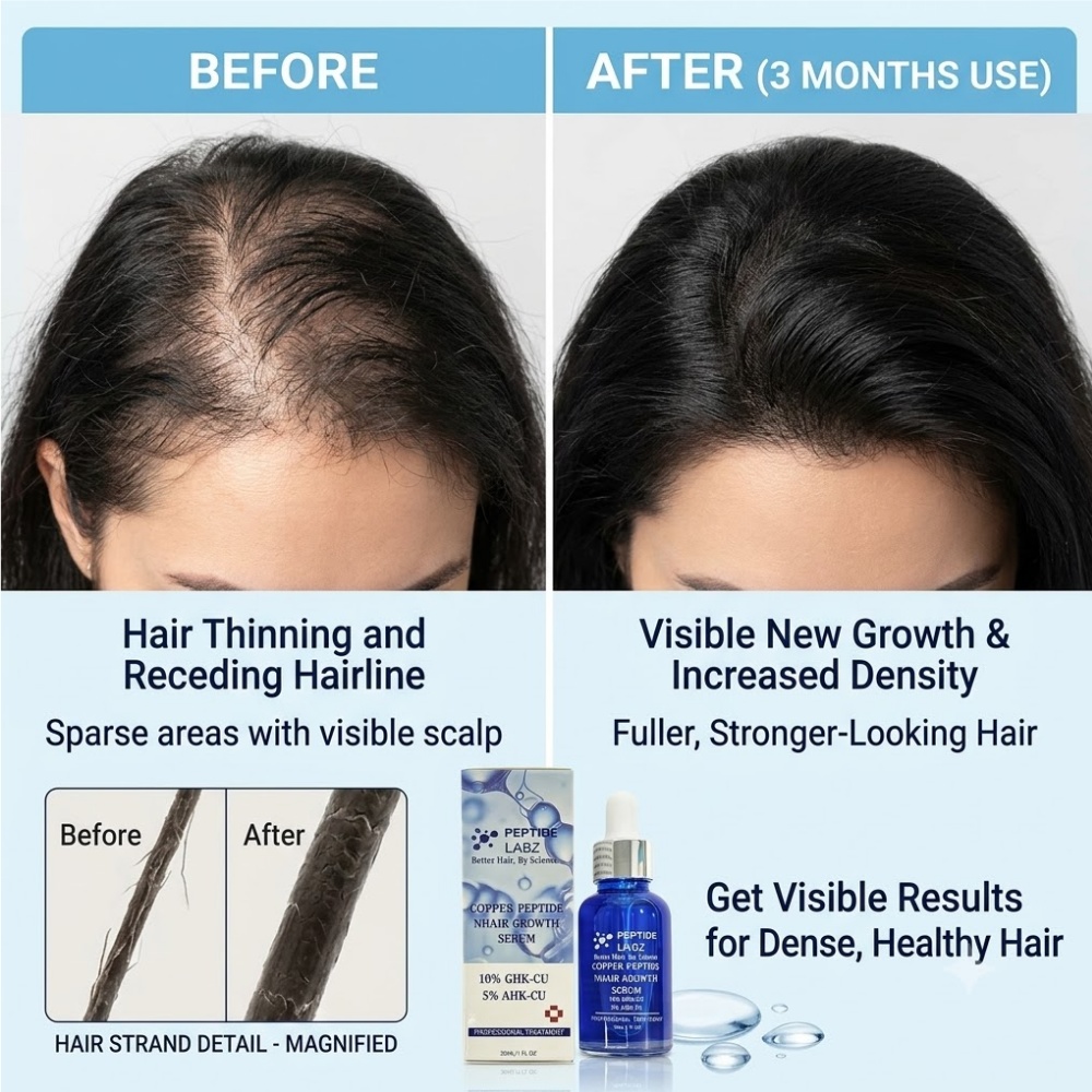 Hair Growth Essence Copper Pep - Hair Care Elseve ulasan dan harga